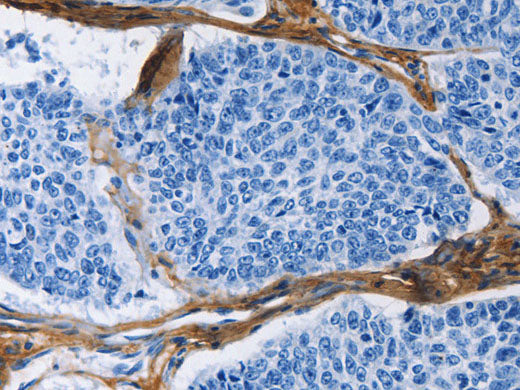 COL3A1 Polyclonal Antibody Store at -20°C