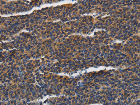 PIAS2 Polyclonal Antibody