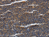 PIAS2 Polyclonal Antibody