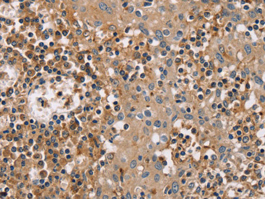 FAIM2 Polyclonal Antibody Store at -20°C