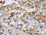 CMTM8 Polyclonal Antibody