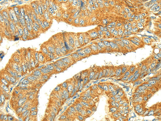 GK1 Polyclonal Antibody Store at -20°C
