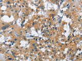 CREB2 Polyclonal Antibody Store at -20°C