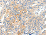 NTRK1 Polyclonal Antibody Store at -20°C