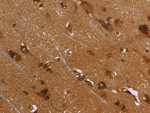 FLNA Polyclonal Antibody Store at -20°C