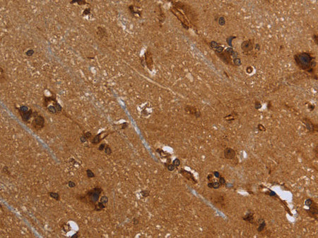 FLNA Polyclonal Antibody Store at -20°C