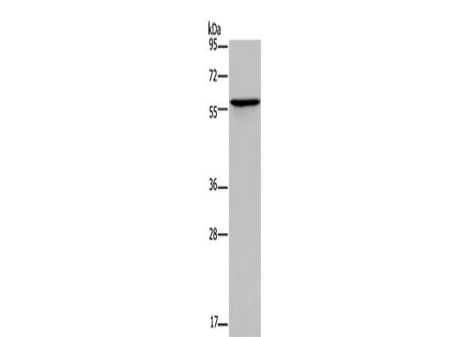 ADRA1B Polyclonal Antibody Store at -20°C