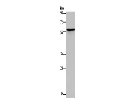 ADRA1B Polyclonal Antibody Store at -20°C