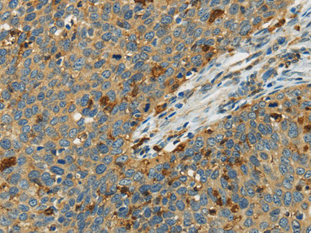 AIF1 Polyclonal Antibody Store at -20°C