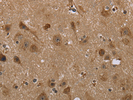 LLGL1 Polyclonal Antibody Store at -20°C