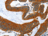 ANAPC10 Polyclonal Antibody Store at -20°C