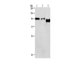 PIP5K1C Polyclonal Antibody Store at -20°C