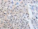 14-3-3 theta Polyclonal Antibody