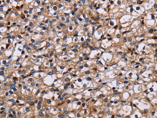 NCSTN Polyclonal Antibody Store at -20°C
