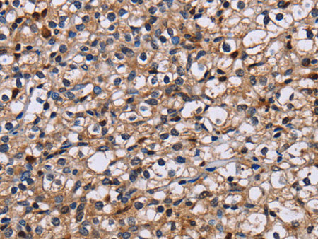NCSTN Polyclonal Antibody Store at -20°C
