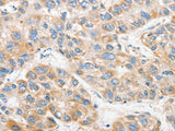 ANAPC2 Polyclonal Antibody Store at -20°C