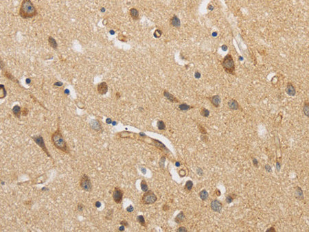 ARF6 Polyclonal Antibody Store at -20°C