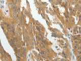 RARA Polyclonal Antibody