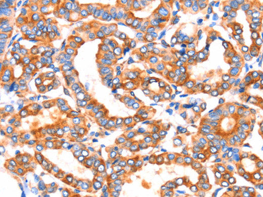 SEPT4 Polyclonal Antibody Store at -20°C