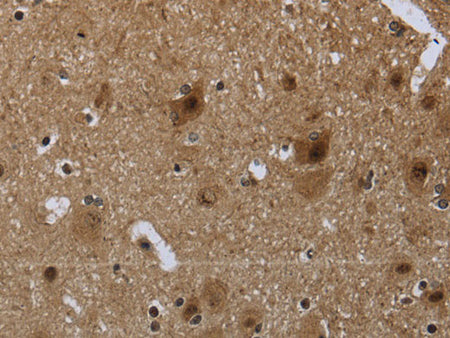 CD236 Polyclonal Antibody Store at -20°C