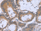 ECE1 Polyclonal Antibody Store at -20°C