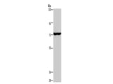 KCND1 Polyclonal Antibody