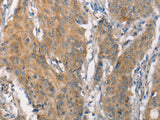 CEACAM6 Polyclonal Antibody Store at -20°C