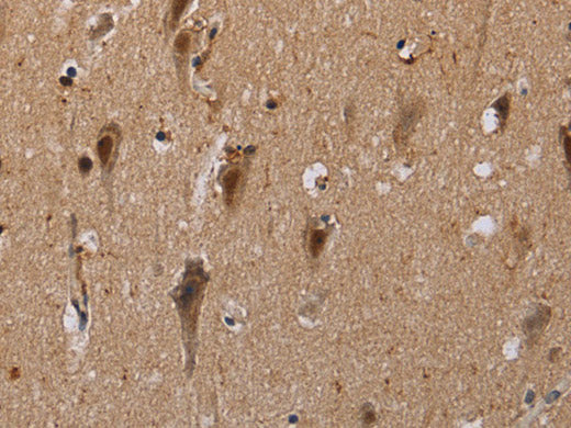 GTF2I Polyclonal Antibody Store at -20°C