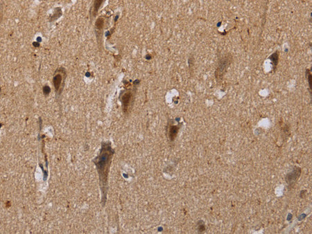 GTF2I Polyclonal Antibody Store at -20°C