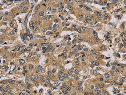 MYL3 Polyclonal Antibody Store at -20°C