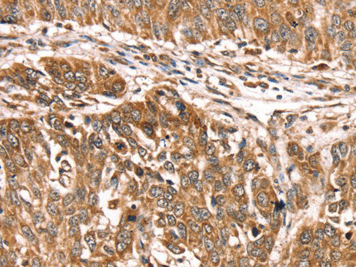 PDLIM4 Polyclonal Antibody Store at -20°C