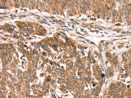 PDLIM4 Polyclonal Antibody Store at -20°C