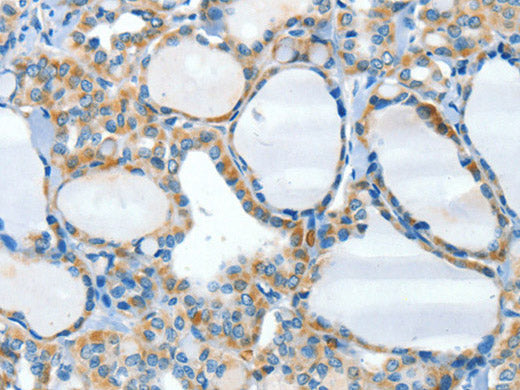 HID1 Polyclonal Antibody Store at -20°C