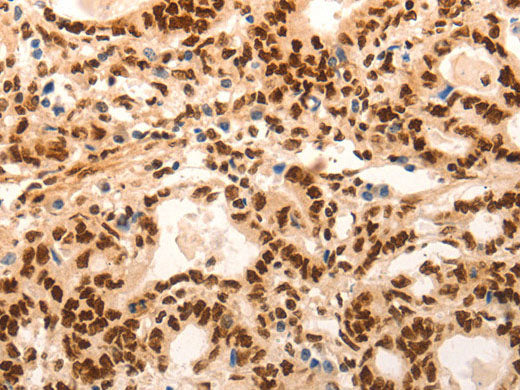 E2F7 Polyclonal Antibody
