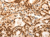 E2F7 Polyclonal Antibody
