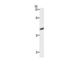SLC16A4 Polyclonal Antibody Store at -20°C