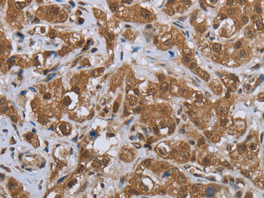 GABRB1 Polyclonal Antibody Store at -20°C