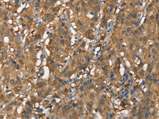 CDC25A Polyclonal Antibody Store at -20°C