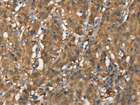 CDC25A Polyclonal Antibody Store at -20°C