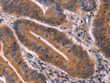 CDC5L Polyclonal Antibody Store at -20°C