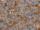 NEDD4L Polyclonal Antibody Store at -20°C