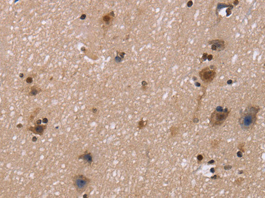 FASTKD5 Polyclonal Antibody Store at -20°C