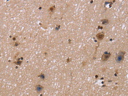 FASTKD5 Polyclonal Antibody Store at -20°C