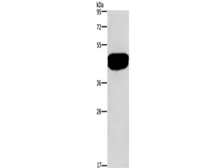 SDCCAG3 Polyclonal Antibody