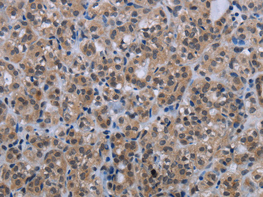 MAGEC1 Polyclonal Antibody Store at -20°C