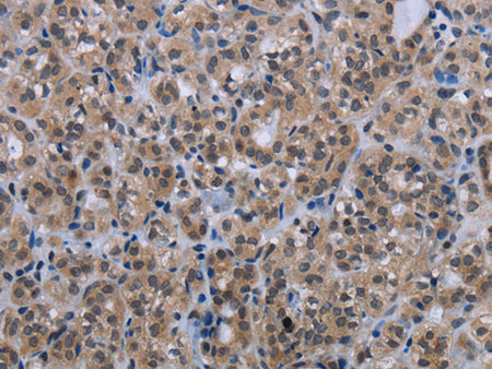 MAGEC1 Polyclonal Antibody Store at -20°C