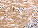 HCRTR1 Polyclonal Antibody Store at -20°C