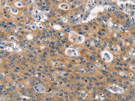 CLTC Polyclonal Antibody Store at -20°C
