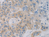 CD303 Polyclonal Antibody Store at -20°C
