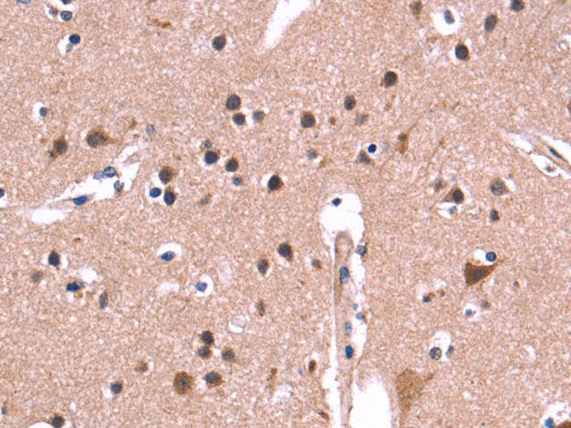 ARC Polyclonal Antibody Store at -20°C